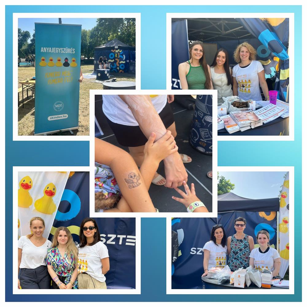 Az MDT brgyógyász kollégái a Szegedi Ifjúsági Napokon is jelen voltak ingyenes anyajegyszréssel 2025. augusztus 28-30. között) 