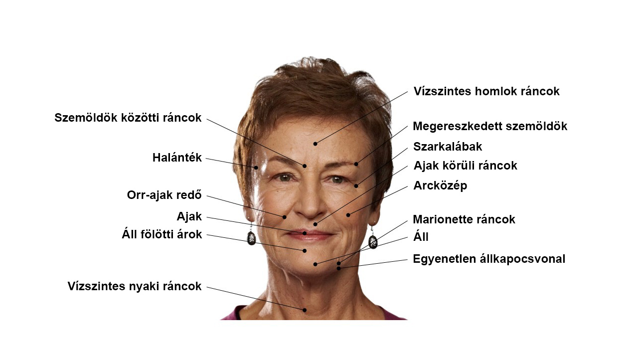 Tltanyagok alkalmazsa eszttikai kezelsek sorn