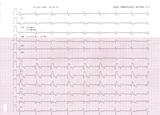 V. EKG feladvnyunk 