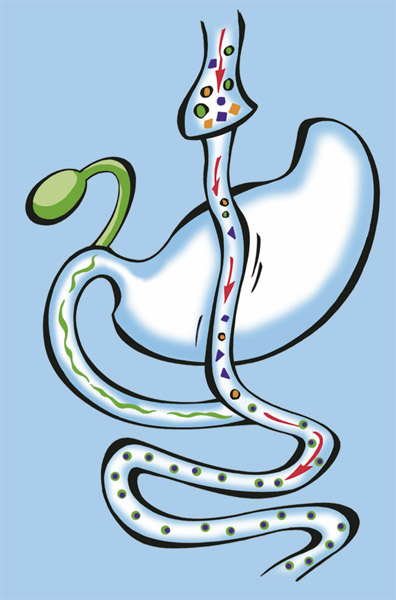 Laparoscopos Roux Y gastric bypass mtét